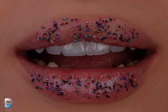 عکس بلیچینگ دندان در کلینیک دندانپزشکی دُرّین