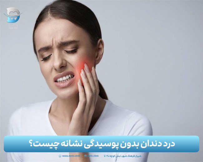 درد دندان بدون پوسیدگی نشانه چیست؟